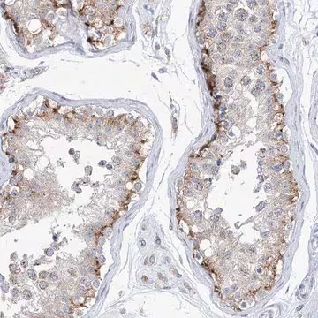 Anti-AGPS antibody produced in rabbit, 1 X 100 µL (HPA030211-100UL)