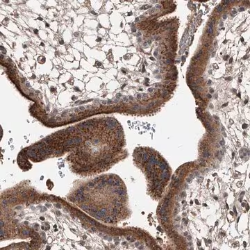 Anti-ZNF25 antibody produced in rabbit, 1 X 100 µL (HPA030190-100UL)