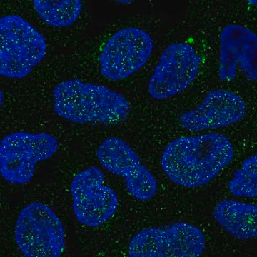 Anti-GALNT14 antibody produced in rabbit, 100 µL (HPA030138-100UL)