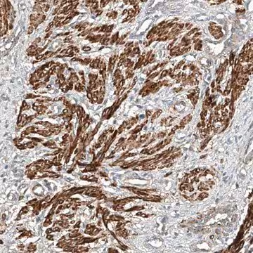Anti-ARHGAP33 antibody produced in rabbit, 1 X 100 µL (HPA030117-100UL)