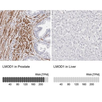 Anti-LMOD1 antibody produced in rabbit, 1 X 100 µL (HPA030097-100UL)