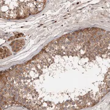 Anti-DNAJC28 antibody produced in rabbit, 1 X 100 µL (HPA030076-100UL)