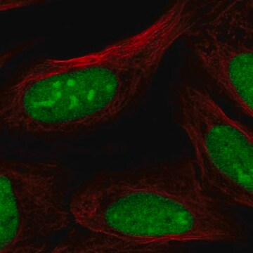 Anti-CRISPLD2 antibody produced in rabbit, 100 µL (HPA030054-100UL)