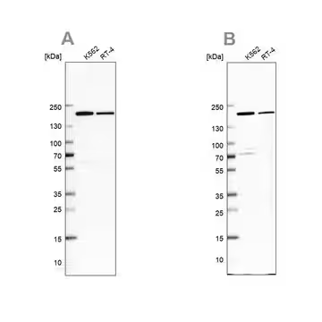 Anti-EPRS antibody produced in rabbit, 1 X 100 µL (HPA030052-100UL)