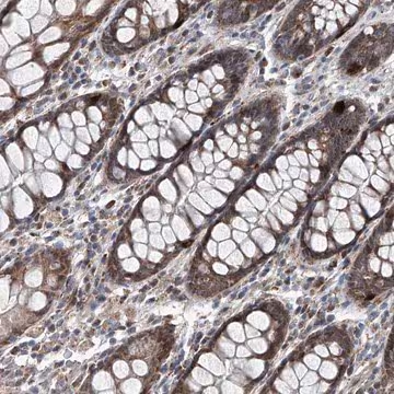 Anti-USP48 antibody produced in rabbit, 1 X 100 µL (HPA030046-100UL)