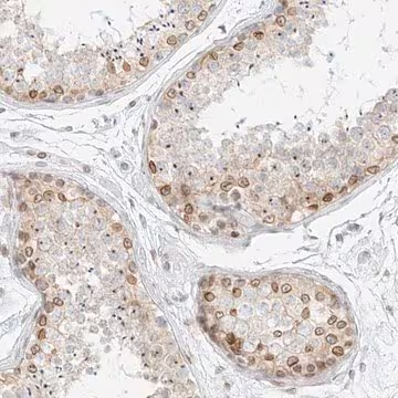Anti-NHSL1 antibody produced in rabbit, 100 µL (HPA029967-100UL)
