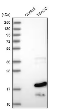 Anti-TSACC antibody produced in rabbit, 1 X 100 µL (HPA029897-100UL)