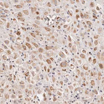 Anti-SCUBE2 antibody produced in rabbit, 1 X 100 µL (HPA029871-100UL)
