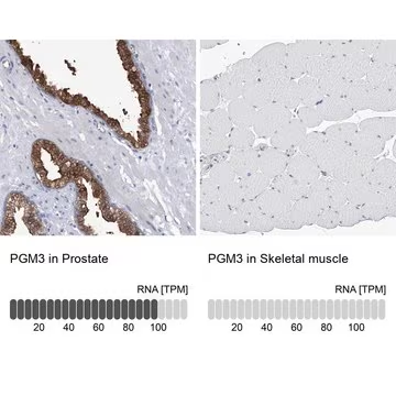 Anti-PGM3 antibody produced in rabbit, 1 X 100 µL (HPA029759-100UL)
