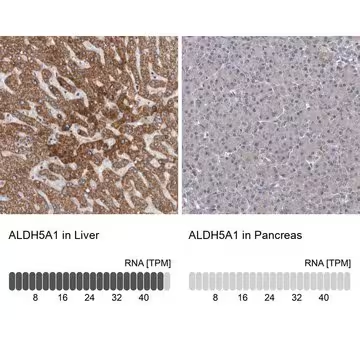 Anti-ALDH5A1 antibody produced in rabbit, 1 X 100 µL (HPA029715-100UL)