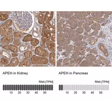 Anti-APEH antibody produced in rabbit, 1 X 100 µL (HPA029700-100UL)
