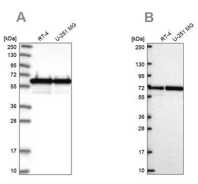 Anti-CCDC47 antibody produced in rabbit, 1 X 100 µL (HPA029674-100UL)
