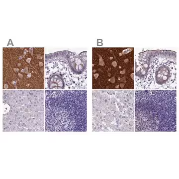 Anti-SNAP91 antibody produced in rabbit, 1 X 100 µL (HPA029633-100UL)