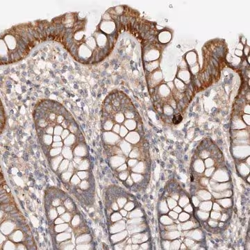 Anti-DMRT2 antibody produced in rabbit, 1 X 100 µL (HPA029297-100UL)