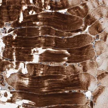 Anti-USP47 antibody produced in rabbit, 1 X 100 µL (HPA029289-100UL)