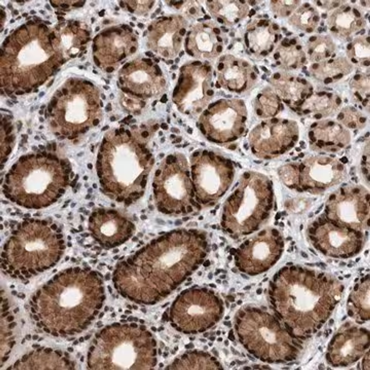 Anti-ZNF260 antibody produced in rabbit, 1 X 100 µL (HPA028806-100UL)