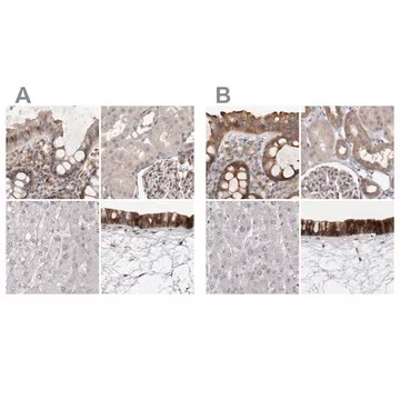 Anti-UFC1 antibody produced in rabbit, 1 X 100 µL (HPA028722-100UL)