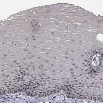 Anti-NVL antibody produced in rabbit, 100 µL (HPA028654-100UL)