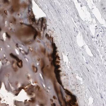 Anti-MATN1 antibody produced in rabbit, 1 X 100 µL (HPA028580-100UL)