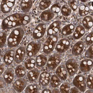 Anti-FLAD1 antibody produced in rabbit, 1 X 100 µL (HPA028563-100UL)