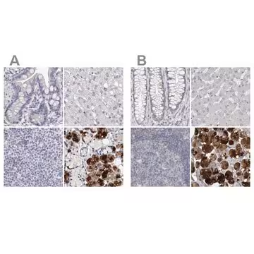 Anti-CA6 antibody produced in rabbit, 1 X 100 µL (HPA028550-100UL)