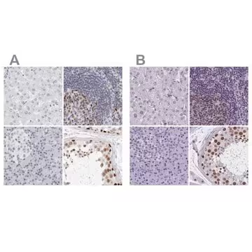 Anti-NASP antibody produced in rabbit, 1 X 100 µL (HPA028136-100UL)