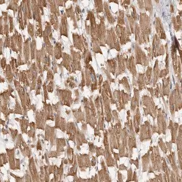 Anti-MAP7D1 antibody produced in rabbit, 1 X 100 µL (HPA028075-100UL)