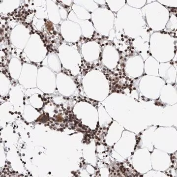 Anti-DTL antibody produced in rabbit, 1 X 100 µL (HPA028016-100UL)