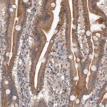 Anti-NMUR1 antibody produced in rabbit, 1 X 100 µL (HPA027895-100UL)