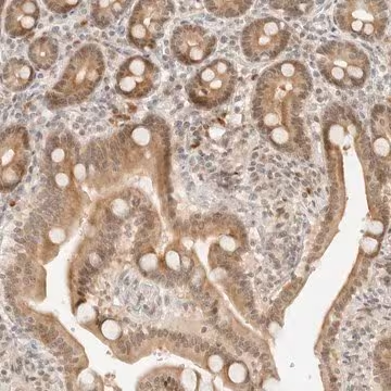 Anti-NEO1 antibody produced in rabbit, 1 X 100 µL (HPA027804-100UL)