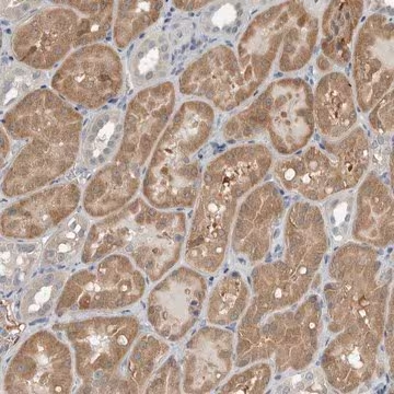 Anti-KYAT1 antibody produced in rabbit, 1 X 100 µL (HPA027736-100UL)