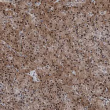 Anti-AKR1A1 antibody produced in rabbit, 1 X 100 µL (HPA027734-100UL)