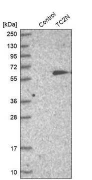 Anti-TC2N antibody produced in rabbit, 1 X 100 µL (HPA027549-100UL)