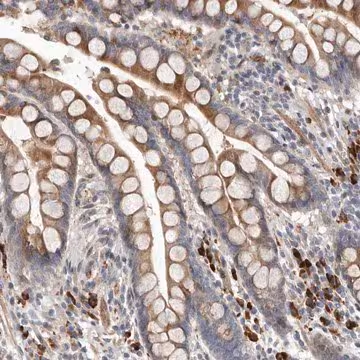 Anti-ATXN3L antibody produced in rabbit, 1 X 100 µL (HPA027539-100UL)