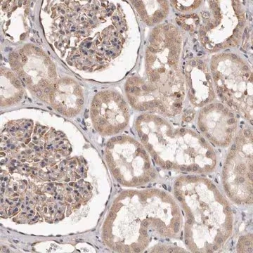 Anti-ALPK1 antibody produced in rabbit, 1 X 100 µL (HPA027443-100UL)