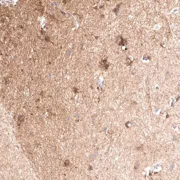 Anti-VPS45 antibody produced in rabbit, 1 X 100 µL (HPA027425-100UL)