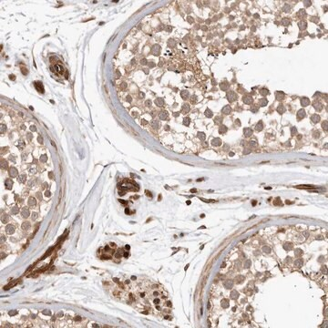 Anti-GPATCH2 antibody produced in rabbit, 1 X 100 µL (HPA027322-100UL)