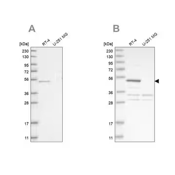 Anti-SCP2 antibody produced in rabbit, 1 X 100 µL (HPA027317-100UL)