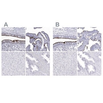 Anti-CCDC181 antibody produced in rabbit, 1 X 100 µL (HPA027281-100UL)
