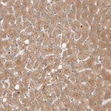 Anti-GNE antibody produced in rabbit, 1 X 100 µL (HPA027258-100UL)