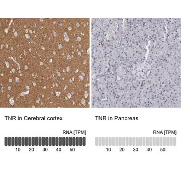Anti-TNR antibody produced in rabbit, 1 X 100 µL (HPA027134-100UL)