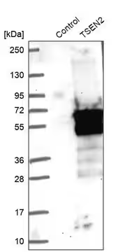 Anti-TSEN2 antibody produced in rabbit, 1 X 100 µL (HPA027125-100UL)