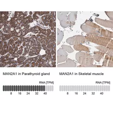 Anti-MAN2A1 antibody produced in rabbit, 1 X 100 µL (HPA026896-100UL)