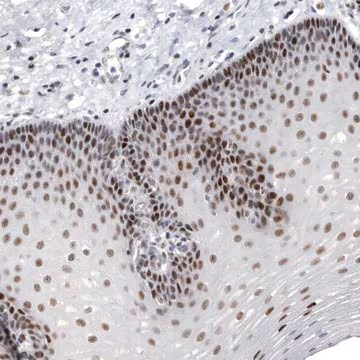 Anti-WRAP73 antibody produced in rabbit, 1 X 100 µL (HPA026893-100UL)