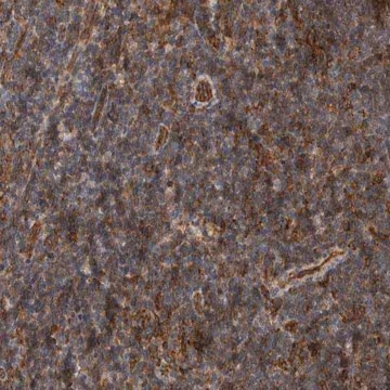 Anti-BNIP2 antibody produced in rabbit, 1 X 100 µL (HPA026843-100UL)