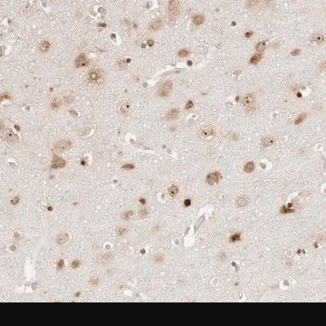 Anti-FKBP14 antibody produced in rabbit, 1 X 100 µL (HPA026829-100UL)