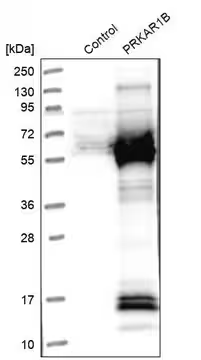 Anti-PRKAR1B antibody produced in rabbit, 1 X 100 µL (HPA026719-100UL)