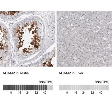 Anti-ADAM2 antibody produced in rabbit, 1 X 100 µL (HPA026581-100UL)