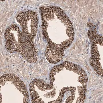 Anti-FAM221B antibody produced in rabbit, 1 X 100 µL (HPA026577-100UL)