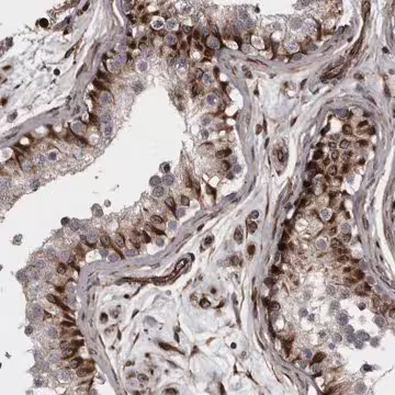 Anti-FAAP100 antibody produced in rabbit, 1 X 100 µL (HPA026532-100UL)